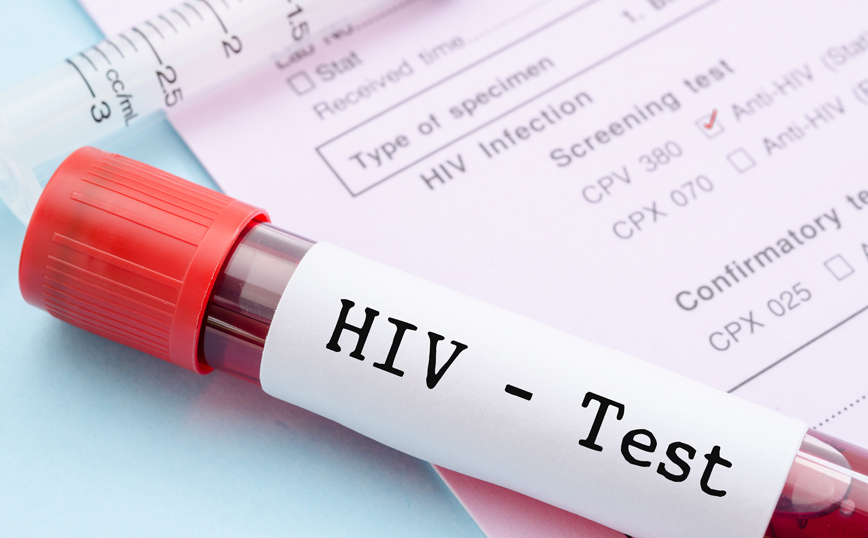 Για πρώτη φορά καταγράφεται σημαντική μείωση των φορέων του HIV στη Νότια Αφρική &#8211; Από το 14% στο 12,7% του πληθυσμού