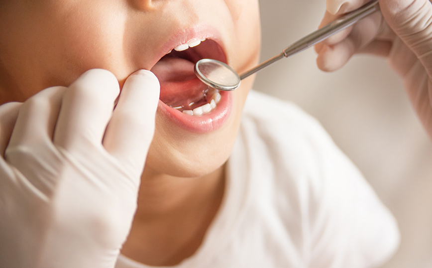 Παραπάνω από 86.000 αιτήσεις τις πρώτες 15 ημέρες για το Dentist Pass