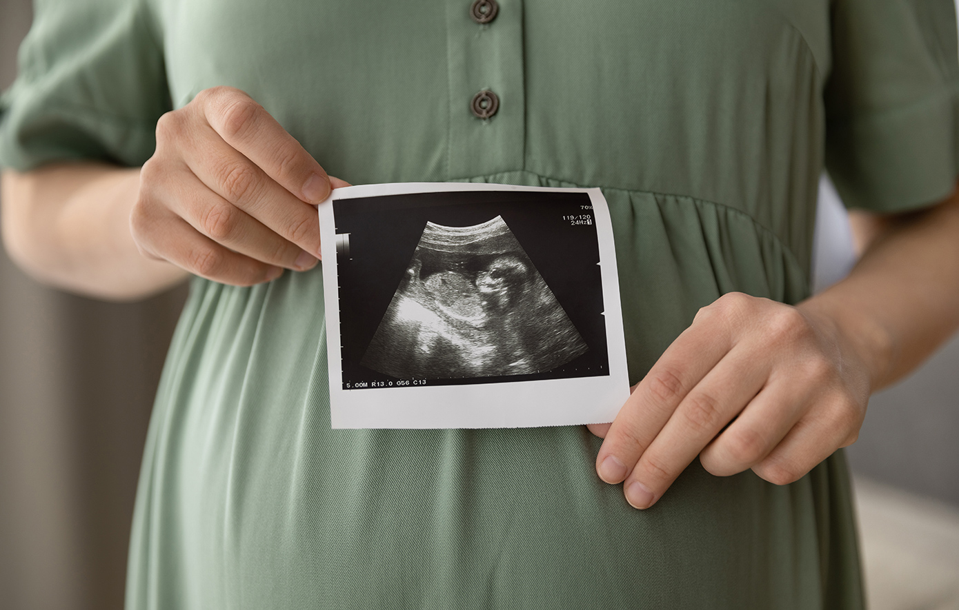 Ενδομητρίωση και εξωσωματική γονιμοποίηση – Τα νεότερα δεδομένα