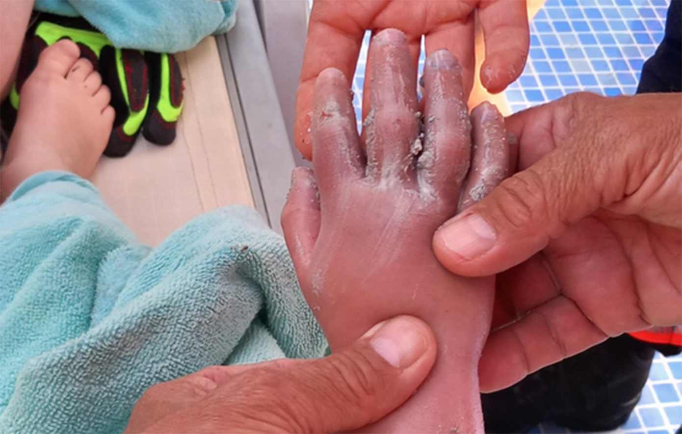 Σωλήνας στην πισίνα ξενοδοχείου ρούφηξε 4χρονο – Δείτε φωτογραφίες