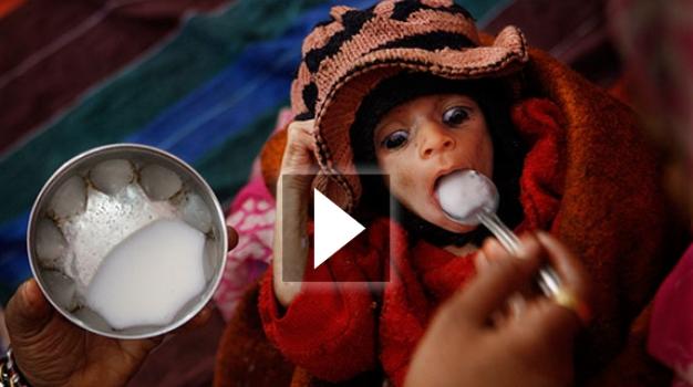 Τραγική, μακάβρια καθημερινότητα ο υποσιτισμός στην Ινδία