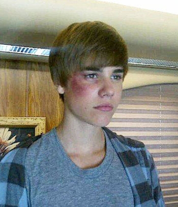 Ποιος χτύπησε τον Justin Bieber;