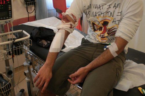 Βίαιες επιθέσεις σε αλλοδαπούς εργάτες στα Χανιά