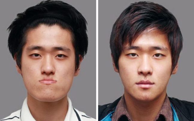 Κορεάτες πριν και μετά την πλαστική