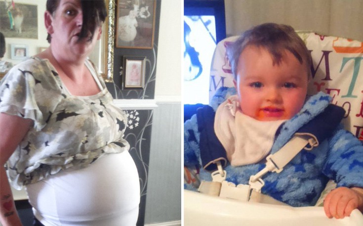 Γυναίκα που για 26 χρόνια δεν είχε περίοδο ανακάλυψε ότι ήταν έγκυος 7 μηνών!