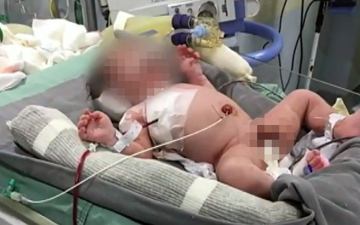 Αγέννητο μωρό τραυματίστηκε από σφαίρα μέσα στην κοιλιά της μαμάς του