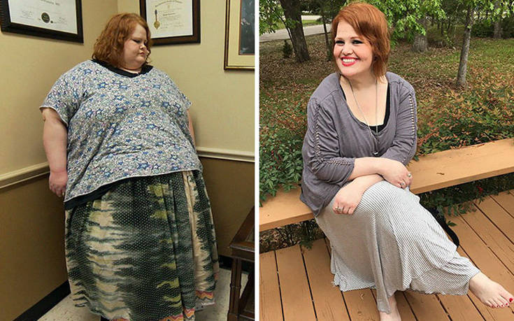 Εντυπωσιακές μεταμορφώσεις ανθρώπων που ζύγιζαν πάνω από 200 κιλά