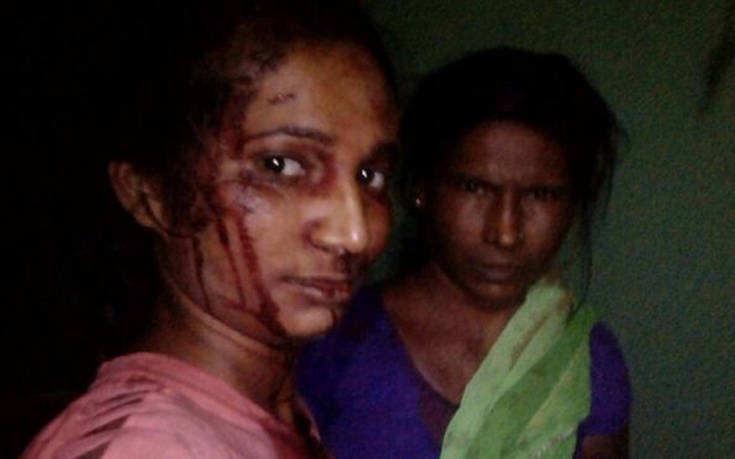 Νεαρή Ινδή έδιωξε με ένα ξύλο τίγρη που είχε επιτεθεί στην κατσίκα της