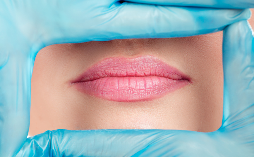 Πώς να αντιμετωπίσετε τις ρυτίδες γύρω από το στόμα