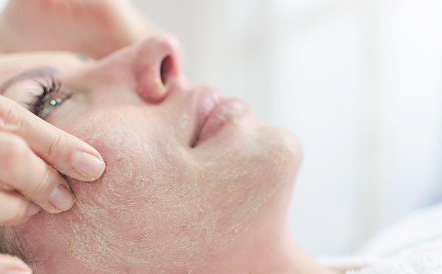 Απολέπιση προσώπου Απολέπιση προσώπου