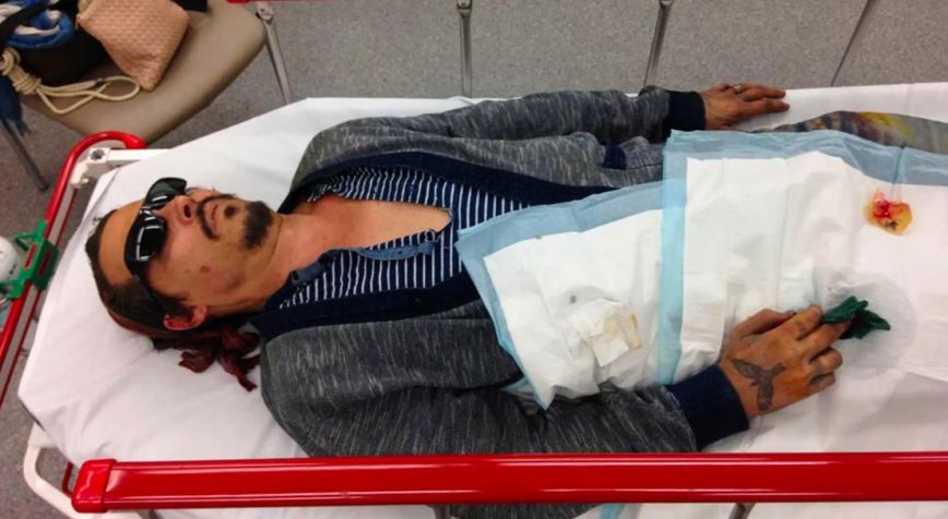 Ο τζόνι Ντεπ τραυματισμένος Ο τζόνι Ντεπ τραυματισμένος