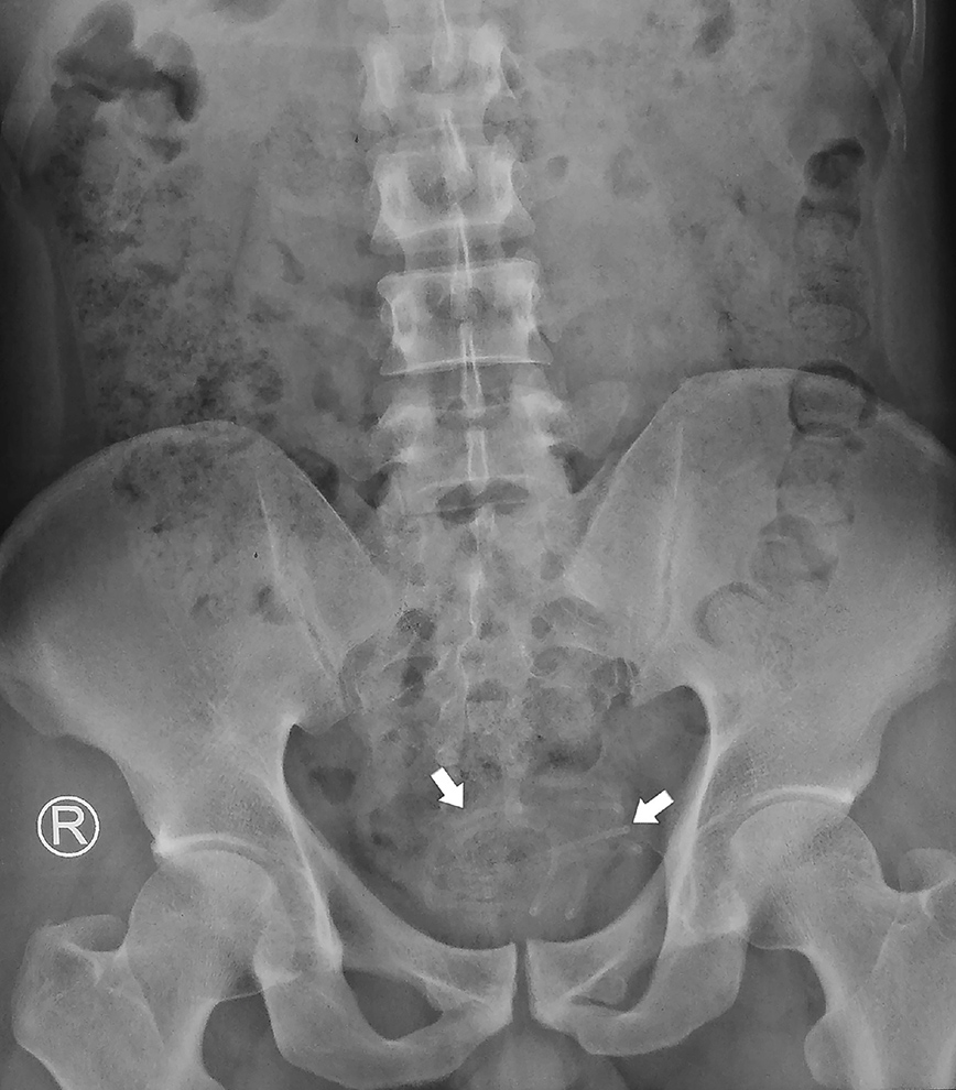 Ακτινογραφία Ακτινογραφία