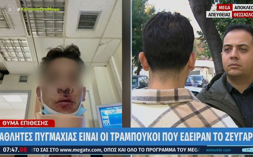 Σοκ στη Θεσσαλονίκη: Αθλητές πυγμαχίας πλάκωσαν στο ξύλο 20χρονο και τη φίλη του