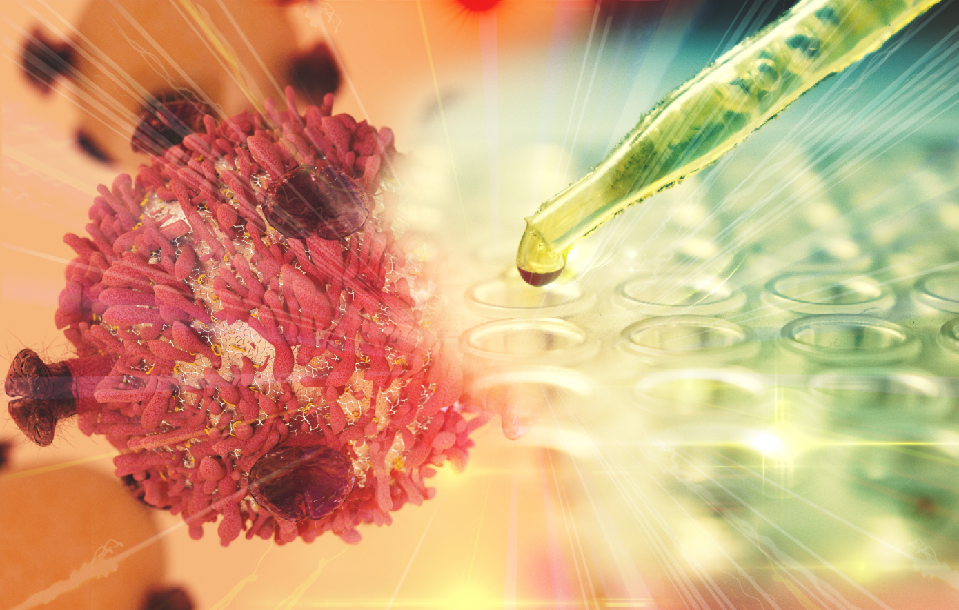 Καρκίνος του εντέρου: Φάρμακο που «λιώνει» όγκους μπορεί να αλλάξει ριζικά τα δεδομένα στη θεραπεία