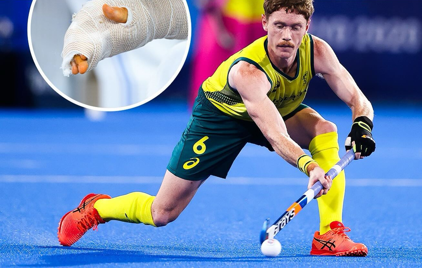 Αυστραλός παίκτης χόκεϊ επί χόρτου ακρωτηρίασε το δάκτυλό του για να αγωνιστεί στους Ολυμπιακούς Αγώνες