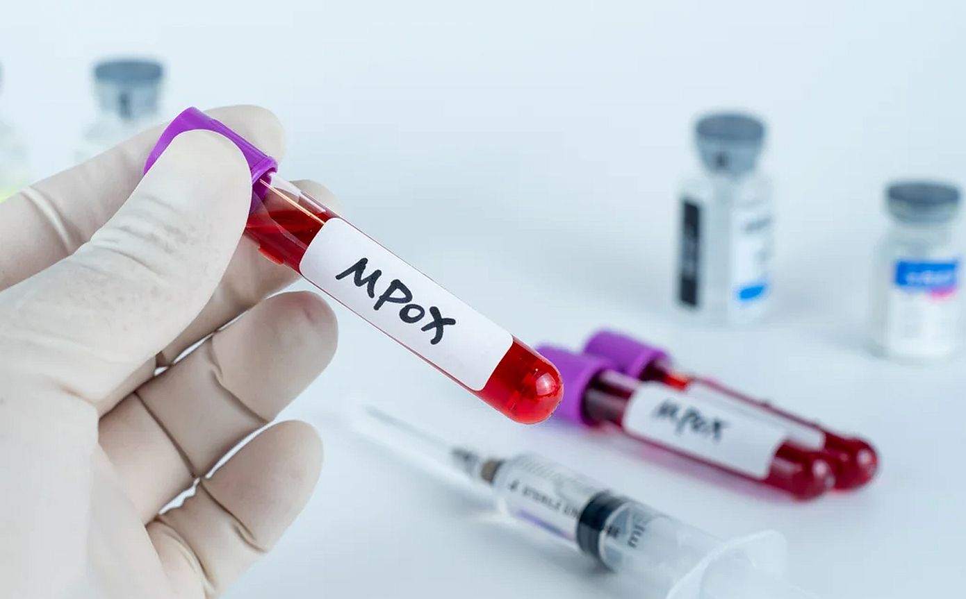 Ευλογιά των πιθήκων &#8211; Η mpox έφτασε ξανά στις Φιλιππίνες &#8211; Επιβεβαιώθηκε το πρώτο κρούσμα για το 2024